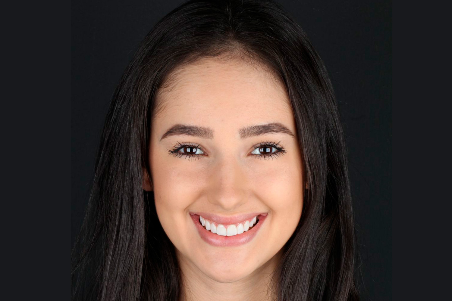 Lentes de Contato Dentais Cuidados