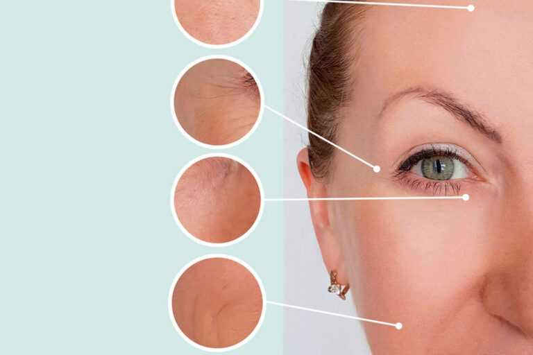 Toxina Botulínica - Canoas - RS