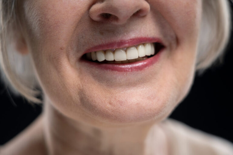 Osso e implante dentário